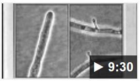 Nematode video part 2